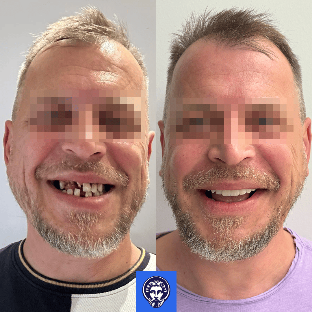 cristian before_after